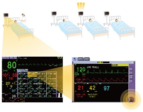 МОНИТОР-ПАЦИЕНТА-NIHON-KOHDEN-Life-Scope-PVM‑2700-функция-interbed